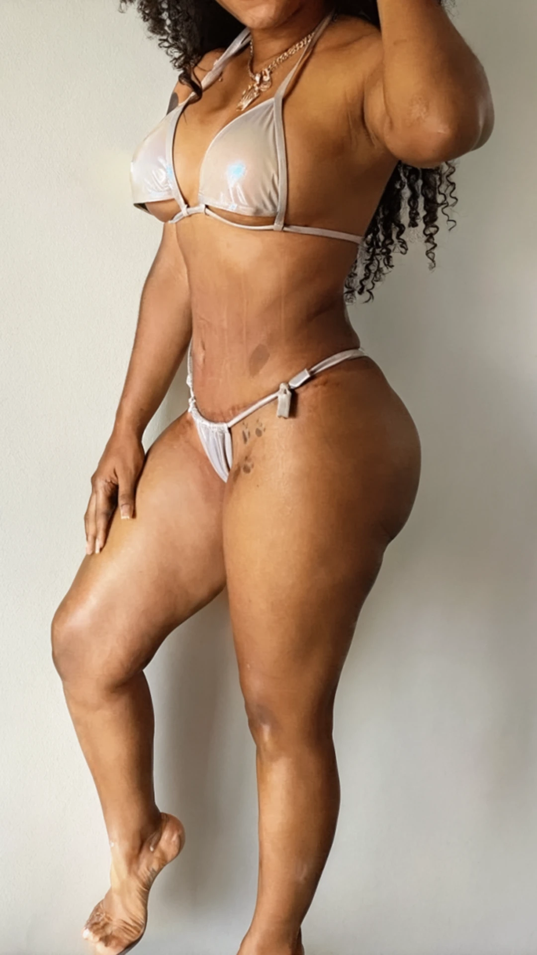 After, Mommy Makeover procedure by Dr. José León, MD - Board Certified Plastic Surgeon, Santo Domingo, Dominican Republic